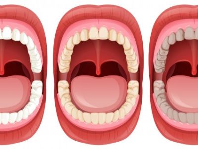 Starostlivosť o ústnu dutinu