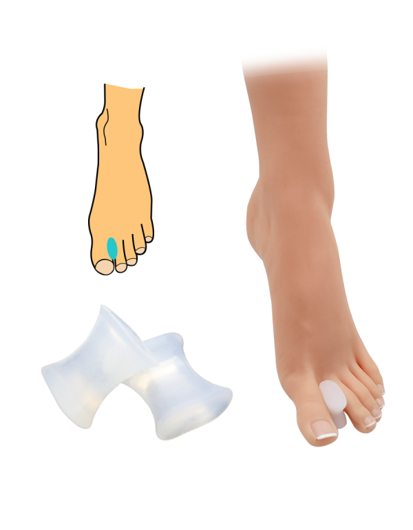 Hallux valgus korektor - telový 2ks